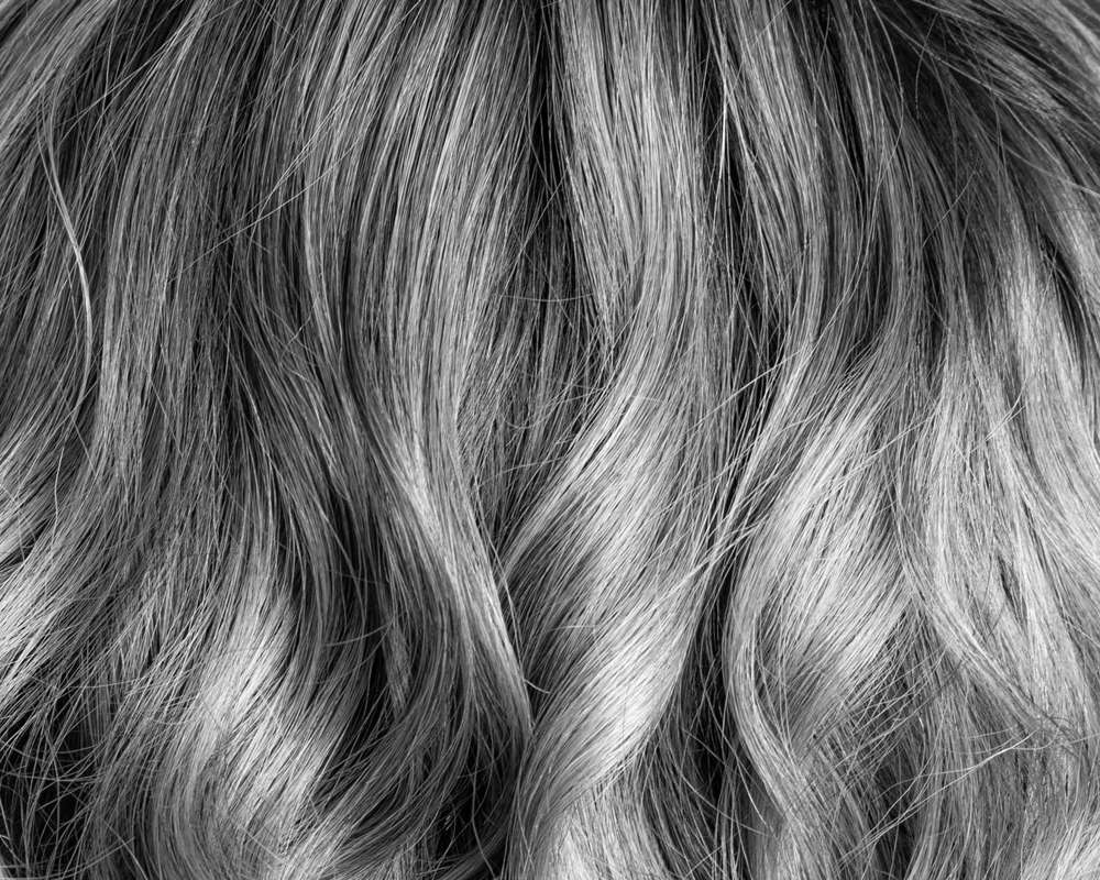 Basico Case Tre Ting Du Kan Laere Af Haarklinikken